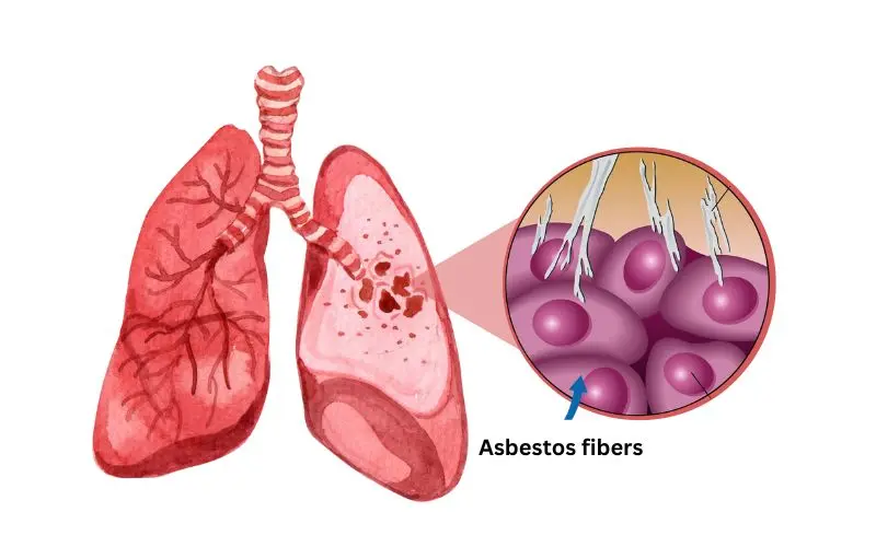 Asbestos: What is it, types, uses, hazards, detection methods, and suitable alternatives